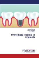 Immediate loading in implants 6200249059 Book Cover