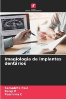 Imagiologia de implantes dentários (Portuguese Edition) 6208558700 Book Cover