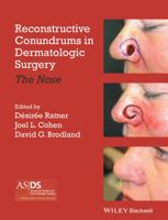 Reconstructive Conundrums in Dermatologic Surgery: The Nose 1118272323 Book Cover