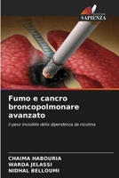 Fumo e cancro broncopolmonare avanzato 663019442X Book Cover