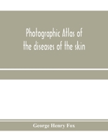 Photographic atlas of the diseases of the skin; A Series of Eighty Plates, Comprising more than One Hundred Illustrations, with Descriptive text, and a Treatise on Cutaneous Therapeutics B0BQ4XGKW2 Book Cover