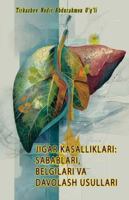 Jigar Kasalliklari - Sabablari, Belgilari Va Davolash Usullari: (Liver Diseases: Causes, Symptoms, and Treatments) 9369088202 Book Cover