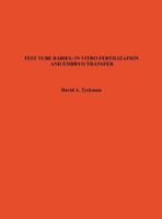 Test Tube Babies: In Vitro Fertilization and Embryo Transfer (Oryx Science Bibliographies, Vol 4) 0897742060 Book Cover