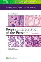 Biopsy Interpretation of the Prostate (Biopsy Interpretation Series) 0781732875 Book Cover
