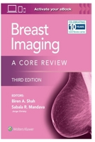Breast Imaging B0BYRH1BTP Book Cover