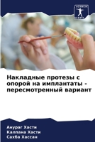 Накладные протезы с ... -  6205893592 Book Cover