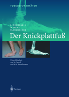 Fussdeformitaten: Der Knickplattfuss 3642631576 Book Cover