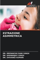 Estrazione Asimmetrica (Italian Edition) 6630111605 Book Cover