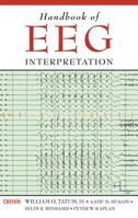 Handbook of EEG Interpretation 1620700166 Book Cover