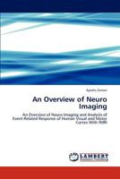 An Overview of Neuro Imaging: An Overview of Neuro Imaging and Analysis of Event-Related Response of Human Visual and Motor Cortex With fMRI 3848419440 Book Cover
