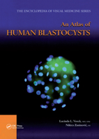 An Atlas of Human Blastocysts 0367395282 Book Cover