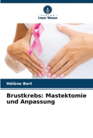 Brustkrebs: Mastektomie und Anpassung 6206005259 Book Cover