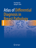 Atlas of Differential Diagnosis in Breast Pathology 1493982761 Book Cover