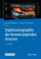 Duplexsonographie Der Hirnversorgenden Arterien 3642298117 Book Cover