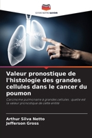 Valeur pronostique de l'histologie des grandes cellules dans le cancer du poumon (French Edition) 6207226437 Book Cover