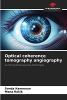 Optical coherence tomography angiography 6208276055 Book Cover