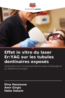 Effet in vitro du laser Er: YAG sur les tubules dentinaires exposés (French Edition) 6208945208 Book Cover