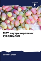 МРТ внутричерепных туберкулом 6206218422 Book Cover