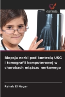 Biopsja nerki pod kontrola USG i tomografii komputerowej w chorobach miazszu nerkowego (Polish Edition) 6209911234 Book Cover