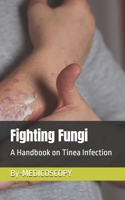 Fighting Fungi: A Handbook on Tinea Infection B0DT4QG2P2 Book Cover