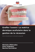 Greffer l'avenir: La matrice dermique acellulaire dans la gestion de la récession (French Edition) 6209717373 Book Cover