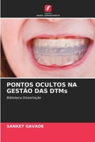PONTOS OCULTOS NA GESTÃO DAS DTMs (Portuguese Edition) 6208532140 Book Cover
