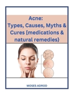 Acne: Types, Causes, Myths & Cures [medications & natural remedies}. B0BRLYJY36 Book Cover