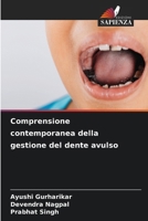 Comprensione contemporanea della gestione del dente avulso (Italian Edition) 620274118X Book Cover