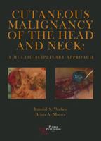 Cutaneous Malignancy of the Head and Neck: A Multidisciplinary Approach 1597563382 Book Cover