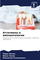 Аттачмены в имплантологии 6206117367 Book Cover