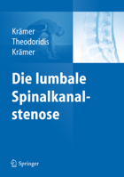 Die Lumbale Spinalkanalstenose 364213842X Book Cover