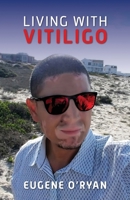 Living with Vitiligo 1928455654 Book Cover