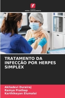 Tratamento Da Infecção Por Herpes Simplex (Portuguese Edition) 6207661397 Book Cover