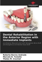 Dental Rehabilitation in the Anterior Region with Immediate Implants 6207546830 Book Cover