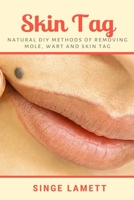 Skin Tag: Natural DIY Methods of removing Mole, Wart and Skin Tag 1637502575 Book Cover