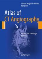 Atlas of CT Angiography: Normal and Pathologic Findings 3319052837 Book Cover