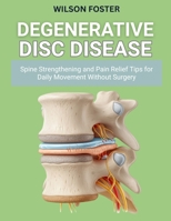 Degenerative Disc Disease: Spine Strengthening and Pain Relief Tips for Daily Movement Without Surgery B0FV4BFC75 Book Cover