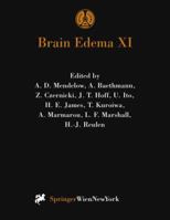 Brain Edema XI: Proceedings of the 11th International Symposium, Newcastle-upon-Tyne, United Kingdom, June 6-10, 1999 321183561X Book Cover