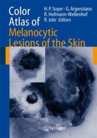 Color Atlas of Melanocytic Lesions of the Skin 3540351051 Book Cover