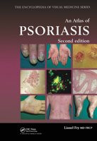 An Atlas of Psoriasis (Encyclopedia of Visual Medicine) 1842142372 Book Cover