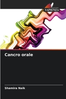 Cancro orale 620415785X Book Cover