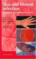 Skin and Wound Infection: Investigation and Treatment in Practice 1853177350 Book Cover