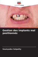 Gestion des implants mal positionnés (French Edition) 6208919207 Book Cover