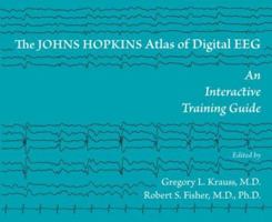 The Johns Hopkins Atlas of Digital EEG: An Interactive Training Guide 0801883725 Book Cover