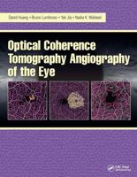 Optical Coherence Tomography Angiography of the Eye: OCT Angiography 1630912824 Book Cover