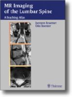 MR-Imaging of the Lumbar Spine: A Teaching Atlas 3131300914 Book Cover
