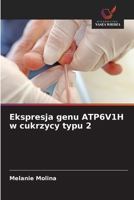 Ekspresja genu ATP6V1H w cukrzycy typu 2 (Polish Edition) 6139600685 Book Cover