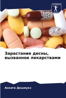 Зарастание десны, вызван 6205790319 Book Cover