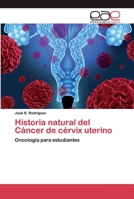 Historia natural del Cáncer de cérvix uterino: Oncología para estudiantes 6200403759 Book Cover