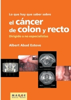 Lo que hay que saber sobre el cáncer de colon y recto (Spanish Edition) 8492442549 Book Cover
